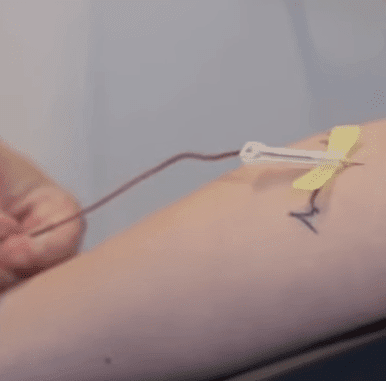 Blutentnahme bei Lipödem Untersuchung