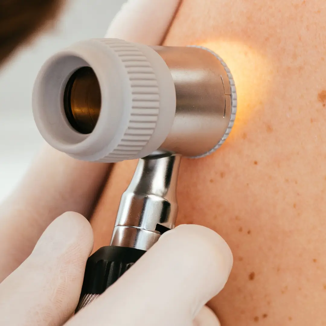 Dermatologen und Lipödem Diagnose