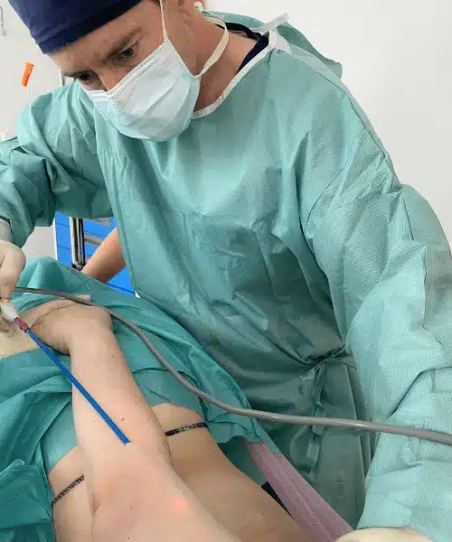 Laser Methode Hautstraffung