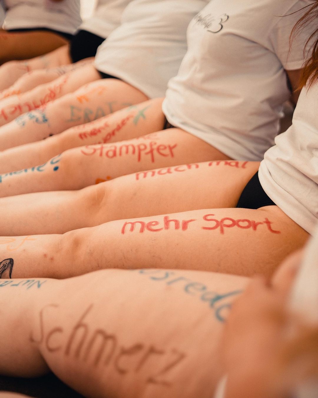 Lipödem Betroffene Frauen Treffen