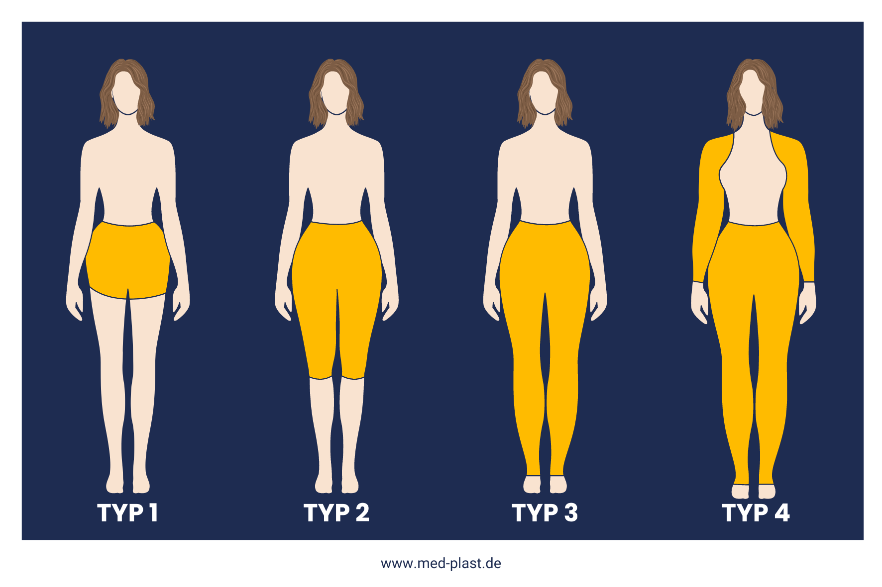 Lipödem Typen Infografik