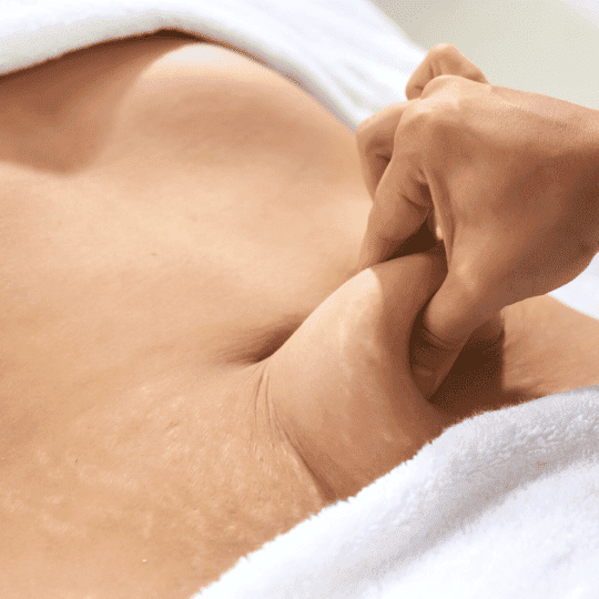 Hautstraffung am Bauch