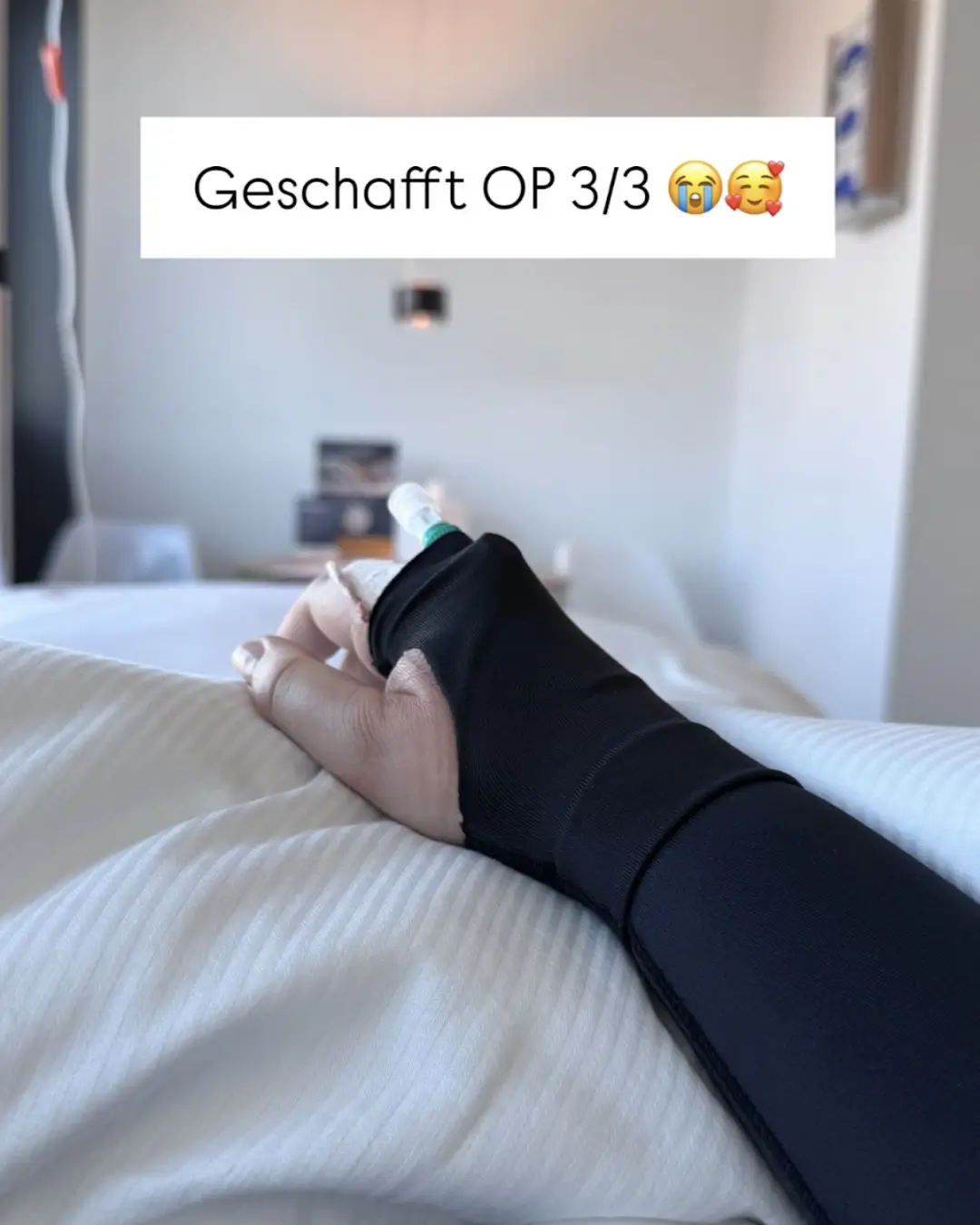 Hand einer Lipödem-Patientin mit Kompressionsärmel nach der dritten Lipödem-OP, liegend im Klinikbett – Text: Geschafft OP 3/3