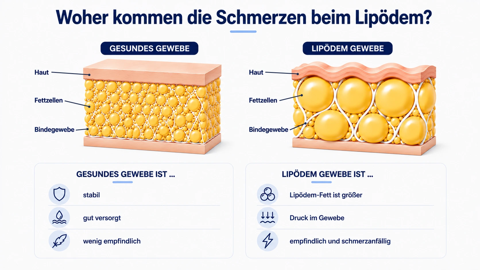 Vergleich von gesundem Gewebe und Lipödem-Gewebe