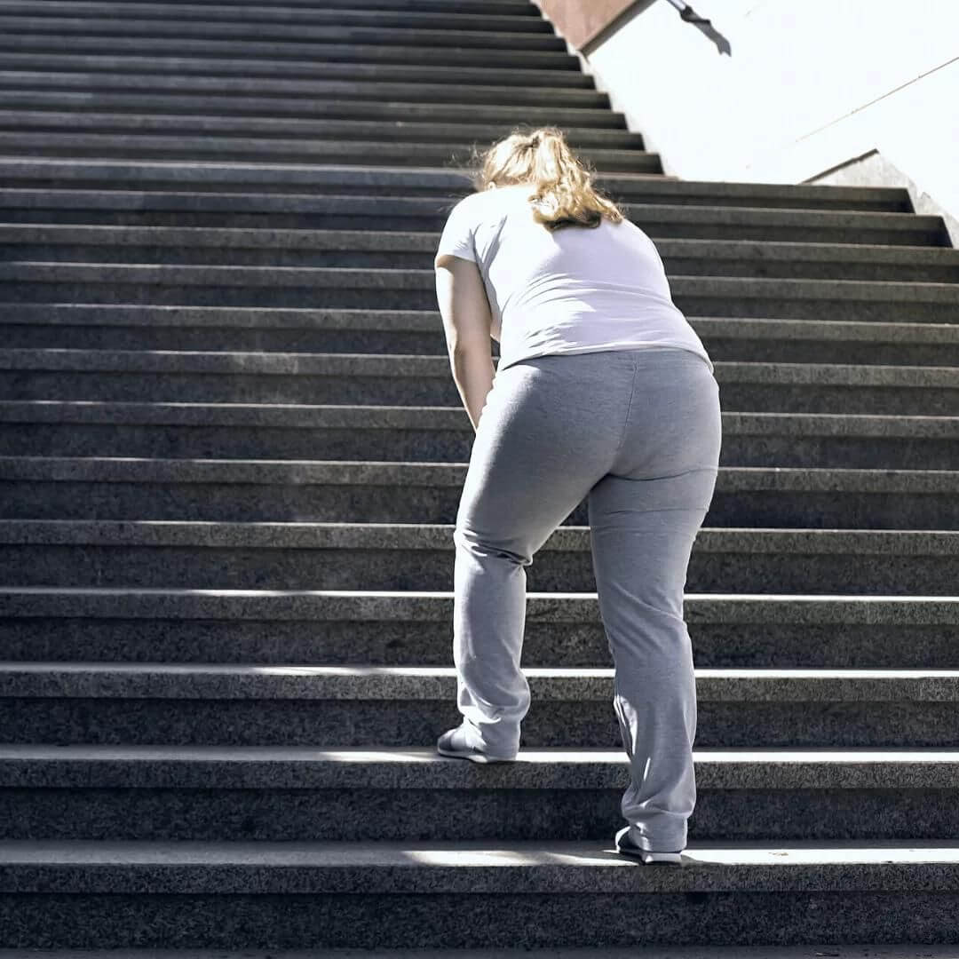 Schmerzen bei Treppe steigern und Lipödem