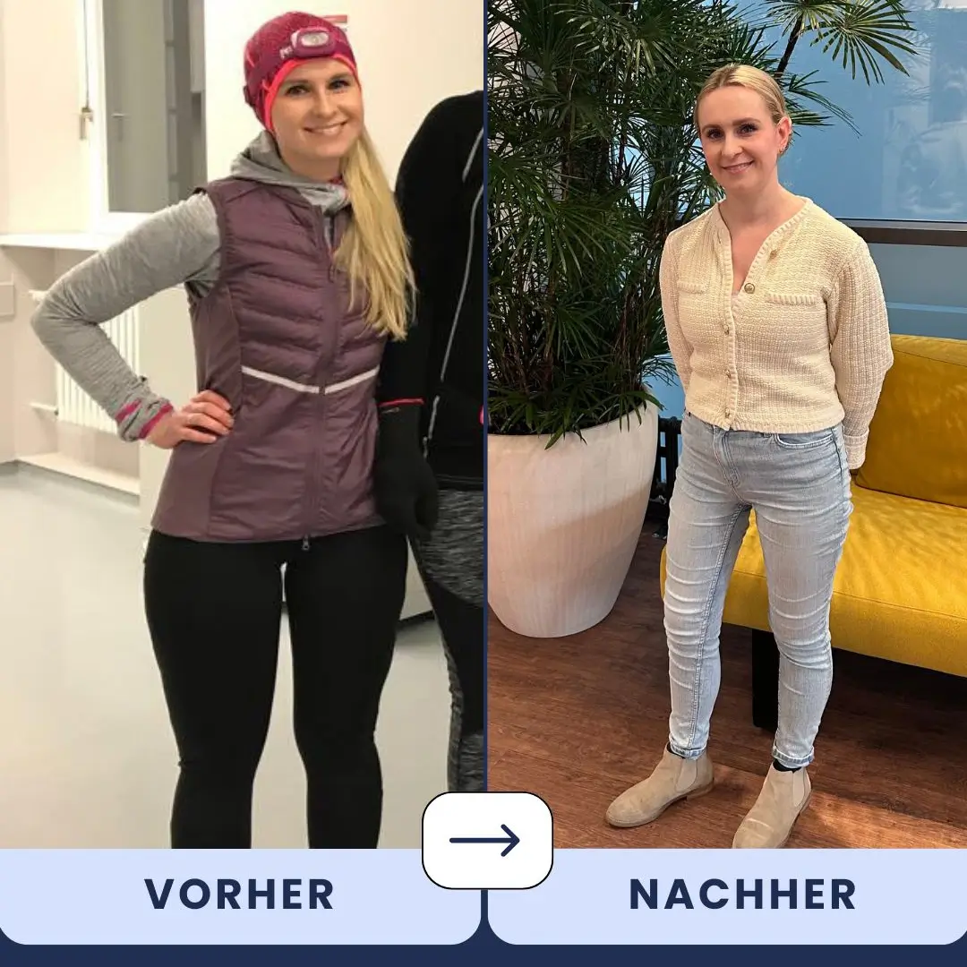 Vorher-Nachher-Foto der Patientin – deutlich schlankere Beine nach Lipödem-OP